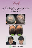 Hair Growth And Anti Dandruff Hair Oil